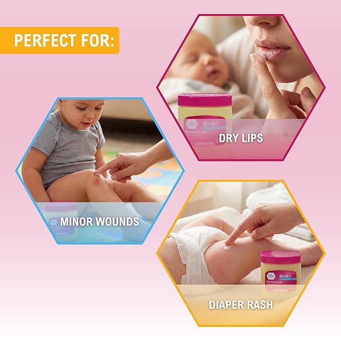 MED PRIDE Petroleum Jelly with Fresh Baby Scent, Pink, 8 oz – Skin Protectant & Moisturizing Ointment for Dry Skin, Rashes, Minor Burns, Chapped Lips & Diaper Rash