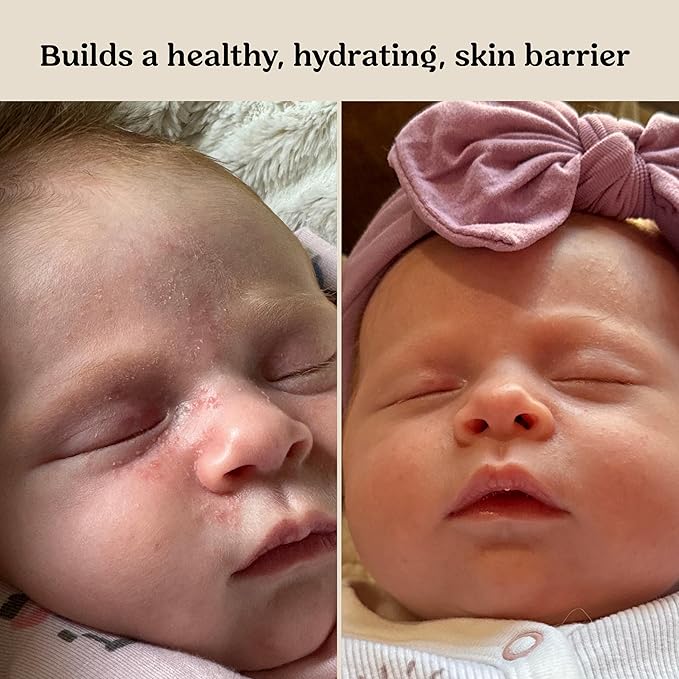 Roe Wellness Baby Cream & Baby Serum Power Pair Biome Barrier | For All Skin & Ages | Hydrating Body, Face, Dry Irritated Skin Toddlers, Newborns Skincare (Power Pair)