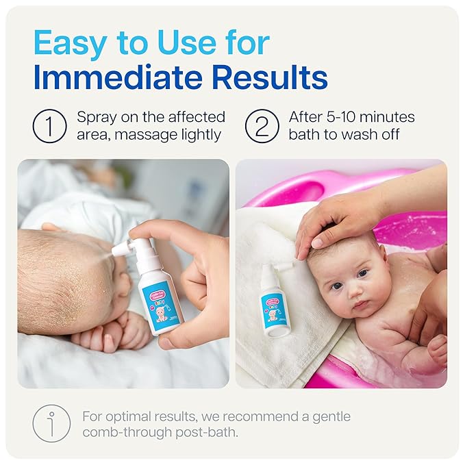 NAVEH PHARMA Cradle Cap Cleanser For Baby & Kids | 100% Natural Cradle Cap Treatment | Spray & Wash No Scrubbing | Better Than Shampoo Or Brush | Help With Dandruff | Olive Oil & Squalane | 1 FL OZ